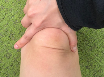 膝痛脂肪体マッサージ